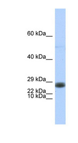 EDF1 / MBF1 Antibody - EDF1 antibody Western blot of Fetal Brain lysate. This image was taken for the unconjugated form of this product. Other forms have not been tested.