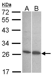 EDN1 / Endothelin 1 Antibody - Sample (30 ug of whole cell lysate). A:293T, B: Hep G2 . 12% SDS PAGE. Endothelin 1 antibody diluted at 1:1000.