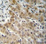 EDN1 / Endothelin 1 Antibody - EDN1 Antibody immunohistochemistry of formalin-fixed and paraffin-embedded human liver tissue followed by peroxidase-conjugated secondary antibody and DAB staining.