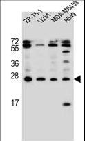 EDN1 / Endothelin 1 Antibody - EDN1 Antibody western blot of ZR-75-1,U251,MDA-MB453,A549 cell line lysates (35 ug/lane). The EDN1 antibody detected the EDN1 protein (arrow).