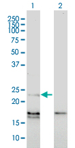 EDN1 / Endothelin 1 Antibody - Western Blot analysis of EDN1 expression in transfected 293T cell line by EDN1 monoclonal antibody (M01), clone 3D6.Lane 1: EDN1 transfected lysate(24 KDa).Lane 2: Non-transfected lysate.