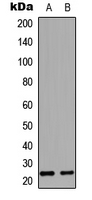 EDN1 / Endothelin 1 Antibody - Western blot analysis of Endothelin 1 expression in HeLa (A); H9C2 (B) whole cell lysates.