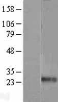 EDN1 / Endothelin 1 Protein - Western validation with an anti-DDK antibody * L: Control HEK293 lysate R: Over-expression lysate