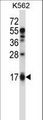 EDN2 / Endothelin 2 Antibody - EDN2 Antibody western blot of K562 cell line lysates (35 ug/lane). The EDN2 antibody detected the EDN2 protein (arrow).