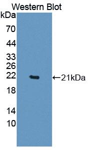EDN2 / Endothelin 2 Antibody - Western blot of EDN2 / Endothelin 2 antibody.