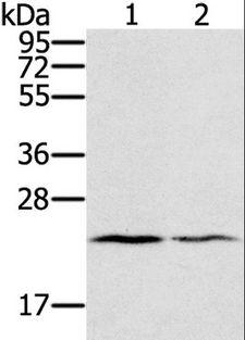 EDN2 / Endothelin 2 Antibody - Western blot analysis of Human normal right lung and normal left lung tissue, using EDN2 Polyclonal Antibody at dilution of 1:600.