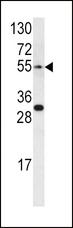 EDNRA / Endothelin A Receptor Antibody - Western blot of EDNRA antibody in CEM cell line lysates (35 ug/lane). EDNRA (arrow) was detected using the purified antibody.