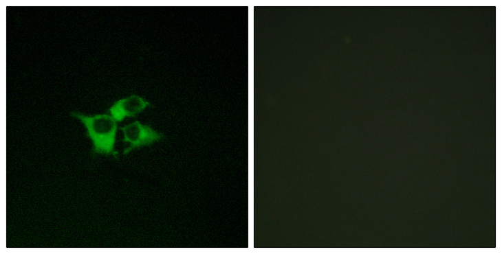 EDNRA / Endothelin A Receptor Antibody - Immunofluorescence analysis of COS7 cells, using EDNRA Antibody. The picture on the right is blocked with the synthesized peptide.
