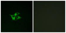 EDNRA / Endothelin A Receptor Antibody - Immunofluorescence analysis of COS7 cells, using EDNRA Antibody. The picture on the right is blocked with the synthesized peptide.
