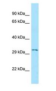 EDNRA / Endothelin A Receptor Antibody - ETA / Endothelin A Receptor antibody Western Blot of Jurkat.  This image was taken for the unconjugated form of this product. Other forms have not been tested.