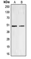 EDNRA / Endothelin A Receptor Antibody - Western blot analysis of Endothelin A Receptor expression in NCIH460 (A); HEK293 (B) whole cell lysates.