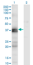 EDNRA / Endothelin A Receptor Antibody - Western Blot analysis of EDNRA expression in transfected 293T cell line by EDNRA monoclonal antibody (M02), clone 2A5.Lane 1: EDNRA transfected lysate(48.7 KDa).Lane 2: Non-transfected lysate.