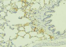 EDNRA / Endothelin A Receptor Antibody - 1:100 staining human lung tissue by IHC-P. The sample was formaldehyde fixed and a heat mediated antigen retrieval step in citrate buffer was performed. The sample was then blocked and incubated with the antibody for 1.5 hours at 22°C. An HRP conjugated goat anti-rabbit antibody was used as the secondary.