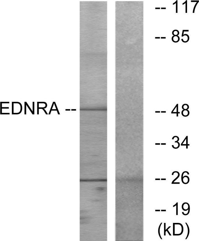 EDNRA / Endothelin A Receptor Antibody - Western blot analysis of extracts from HepG2 cells, using EDNRA antibody.