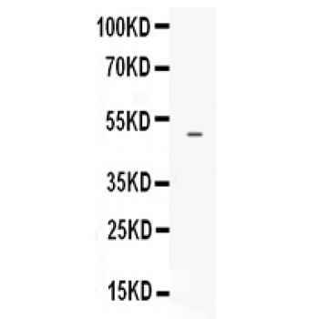 EDNRB / Endothelin B Receptor Antibody - EDNRB antibody Western blot. All lanes: Anti EDNRB at 0.5 ug/ml. WB: HELA Whole Cell Lysate at 40 ug. Predicted band size: 50 kD. Observed band size: 50 kD.