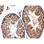 EDNRB / Endothelin B Receptor Antibody - EDNRB antibody IHC-paraffin. IHC(P): Mouse Testis Tissue.