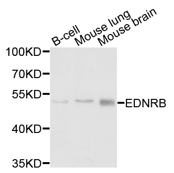 EDNRB / Endothelin B Receptor Antibody - Western blot analysis of extracts of various cells.