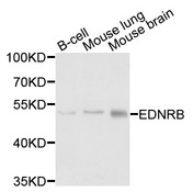 EDNRB / Endothelin B Receptor Antibody - Western blot analysis of extracts of various cells.