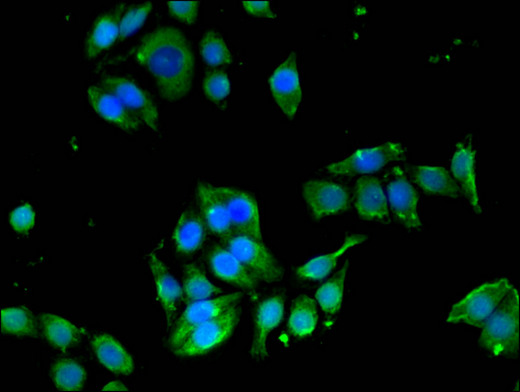 EDNRB / Endothelin B Receptor Antibody - Immunofluorescent analysis of PC3 cells using EDNRB Antibody at a dilution of 1:100 and Alexa Fluor 488-congugated AffiniPure Goat Anti-Rabbit IgG(H+L)