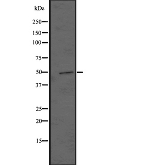 EDNRB / Endothelin B Receptor Antibody - Western blot analysis of EDNRB expression in HEK293 cells. The lane on the left is treated with the antigen-specific peptide.