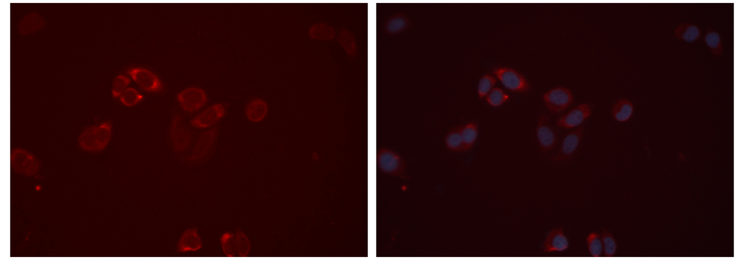 EDNRB / Endothelin B Receptor Antibody - Staining HeLa cells by IF/ICC. The samples were fixed with PFA and permeabilized in 0.1% Triton X-100, then blocked in 10% serum for 45 min at 25°C. The primary antibody was diluted at 1:200 and incubated with the sample for 1 hour at 37°C. An Alexa Fluor 594 conjugated goat anti-rabbit IgG (H+L) antibody, diluted at 1/600 was used as secondary antibody.