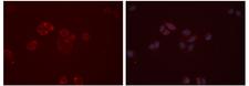 EDNRB / Endothelin B Receptor Antibody - Staining HeLa cells by IF/ICC. The samples were fixed with PFA and permeabilized in 0.1% Triton X-100, then blocked in 10% serum for 45 min at 25°C. The primary antibody was diluted at 1:200 and incubated with the sample for 1 hour at 37°C. An Alexa Fluor 594 conjugated goat anti-rabbit IgG (H+L) antibody, diluted at 1/600 was used as secondary antibody.
