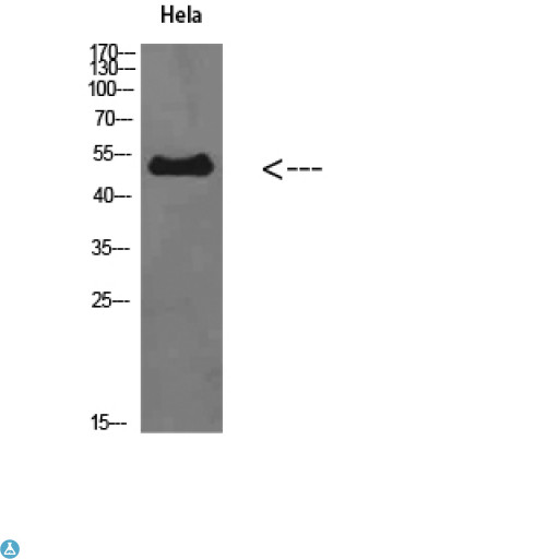 EDNRB / Endothelin B Receptor Antibody - Immunohistochemical analysis of paraffin-embedded human-placenta, antibody was diluted at 1:200.