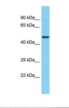 EDR / PEG10 Antibody - Western blot of Human Thyroid Tumor. PEG10 antibody dilution 1.0 ug/ml.  This image was taken for the unconjugated form of this product. Other forms have not been tested.