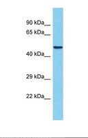 EDR / PEG10 Antibody - Western blot of Human Thyroid Tumor. PEG10 antibody dilution 1.0 ug/ml.  This image was taken for the unconjugated form of this product. Other forms have not been tested.