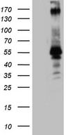 EDR / PEG10 Antibody - HEK293T cells were transfected with the pCMV6-ENTRY control. (Left lane) or pCMV6-ENTRY PEG10. (Right lane) cDNA for 48 hrs and lysed. Equivalent amounts of cell lysates. (5 ug per lane) were separated by SDS-PAGE and immunoblotted with anti-PEG10. (1:2000)(1:500)