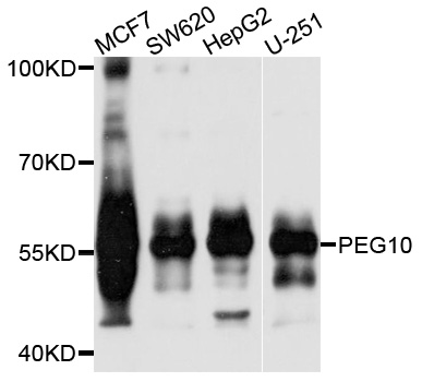 EDR / PEG10 Antibody - Western blot analysis of extracts of various cells.