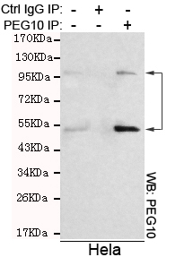 EDR / PEG10 Antibody - Immunoprecipitation analysis of HeLa cell lysates using PEG10 mouse monoclonal antibody.