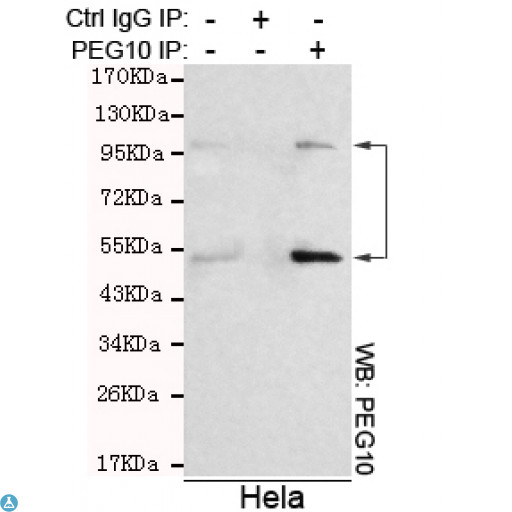 EDR / PEG10 Antibody - Immunoprecipitation analysis of Hela cell lysates using PEG10 mouse mAb.