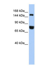 EEA1 Antibody - EEA1 antibody Western blot of 721_B cell lysate. This image was taken for the unconjugated form of this product. Other forms have not been tested.