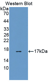 EEA1 Antibody - Western blot of EEA1 antibody.