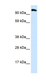 EEA1 Antibody - EEA1 antibody Western blot of Placenta lysate. This image was taken for the unconjugated form of this product. Other forms have not been tested.