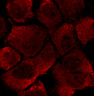 EEA1 Antibody - Immunofluorescence. Immunostaining of Hepa1-6 cells with EEA1 antibody at 1:50 dilution.