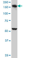 EEA1 Antibody - EEA1 monoclonal antibody (M02A), clone 1D4 Western Blot analysis of EEA1 expression in A-431.