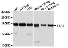 EEA1 Antibody - Western blot analysis of extracts of various cell lines, using EEA1 antibody at 1:1000 dilution. The secondary antibody used was an HRP Goat Anti-Rabbit IgG (H+L) at 1:10000 dilution. Lysates were loaded 25ug per lane and 3% nonfat dry milk in TBST was used for blocking. An ECL Kit was used for detection and the exposure time was 5s.