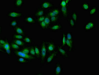 EEA1 Antibody - Immunofluorescent analysis of Hela cells at a dilution of 1:100 and Alexa Fluor 488-congugated AffiniPure Goat Anti-Rabbit IgG(H+L)