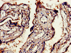 EEA1 Antibody - Immunohistochemistry image of paraffin-embedded human placenta tissue at a dilution of 1:100