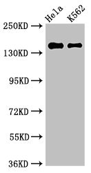 EEA1 Antibody - Positive Western Blot detected in Hela whole cell lysate, K562 whole cell lysate. All lanes: EEA1 antibody at 3 µg/ml Secondary Goat polyclonal to rabbit IgG at 1/50000 dilution. Predicted band size: 163 KDa. Observed band size: 163 KDa
