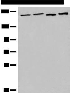 EEA1 Antibody - Western blot analysis of 293T cell Human metastatic malignant melanoma tissue lysates  using EEA1 Polyclonal Antibody at dilution of 1:700