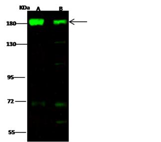EEA1 Antibody - Anti-EEA1 rabbit polyclonal antibody at 1:500 dilution. Lane A: HeLa Whole Cell Lysate. Lane B: A549 Whole Cell Lysate. Lysates/proteins at 30 ug per lane. Secondary: Goat Anti-Rabbit IgG H&L (Dylight 800) at 1/10000 dilution. Developed using the Odyssey technique. Performed under reducing conditions. Predicted band size: 162 kDa. Observed band size: 180 kDa. (We are unsure as to the identity of these extra bands.)