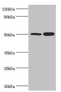 EED Antibody - Western blot All lanes: Polycomb protein EED antibody at 4µg/ml Lane 1: Hela whole cell lysate Lane 2: K562 whole cell lysate Secondary Goat polyclonal to rabbit IgG at 1/10000 dilution Predicted band size: 51, 54, 46 kDa Observed band size: 51 kDa