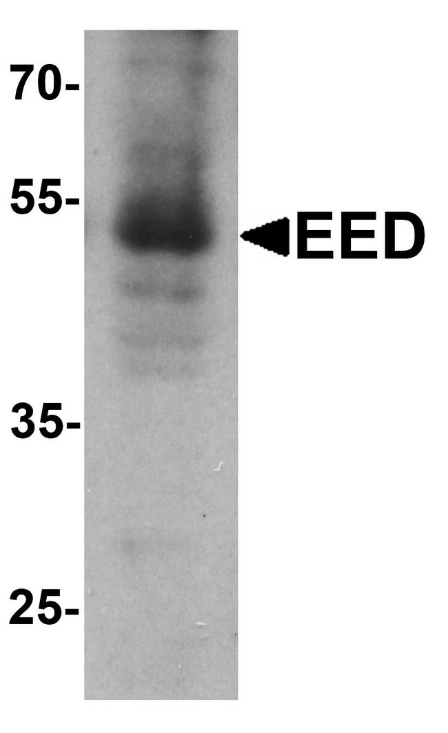 EED Antibody - Western blot analysis of EED in human heart tissue lysate with Eed antibody at 1 ug/ml.