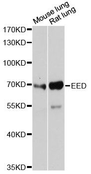 EED Antibody - Western blot analysis of extracts of various cell lines, using EED antibody at 1:3000 dilution. The secondary antibody used was an HRP Goat Anti-Rabbit IgG (H+L) at 1:10000 dilution. Lysates were loaded 25ug per lane and 3% nonfat dry milk in TBST was used for blocking. An ECL Kit was used for detection and the exposure time was 90s.
