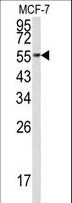 EEF1A1 Antibody - Western blot of EEF1A1 Antibody in MCF-7 cell line lysates (35 ug/lane). EEF1A1 (arrow) was detected using the purified antibody.