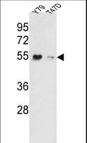 EEF1A1 Antibody - Western blot of EEF1A1 Antibody in Y79, T47D cell line lysates (35 ug/lane). EEF1A1 (arrow) was detected using the purified antibody.