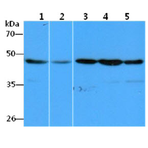 EEF1A1 Antibody - The Cell lysates (40ug) were resolved by SDS-PAGE, transferred to PVDF membrane and probed with anti-human EEF1A1 antibody (1:1000). Proteins were visualized using a goat anti-mouse secondary antibody conjugated to HRP and an ECL detection system. Lane 1.: HeLa cell lysate Lane 2.: A549 cell lysate Lane 3.: Raji cell lysate Lane 4.: THP-1 cell lysate Lane 5.: MCF-7 cell lysate
